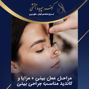عمل بینی