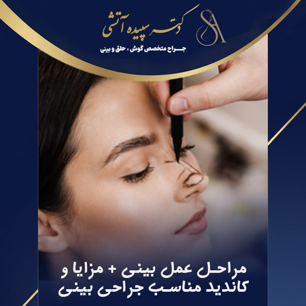 عمل بینی