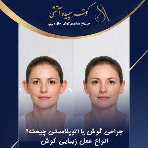 جراحی گوش یا اتوپلاستی چیست؟ انواع عمل زیبایی گوش